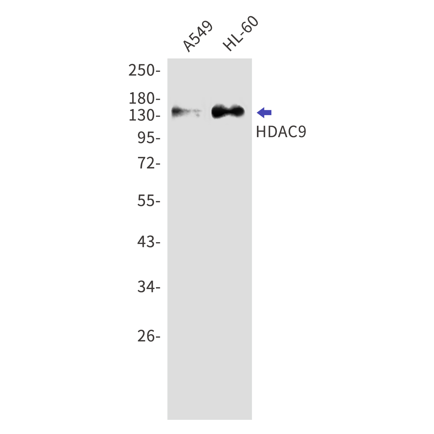 HDAC9 Rabbit mAb