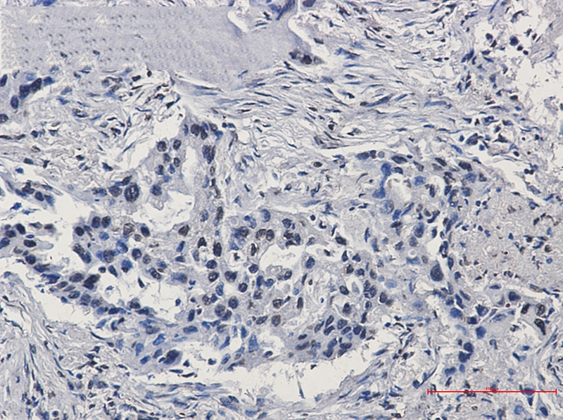 HIF1 beta Rabbit mAb