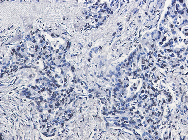 Histone H2A.X Rabbit mAb