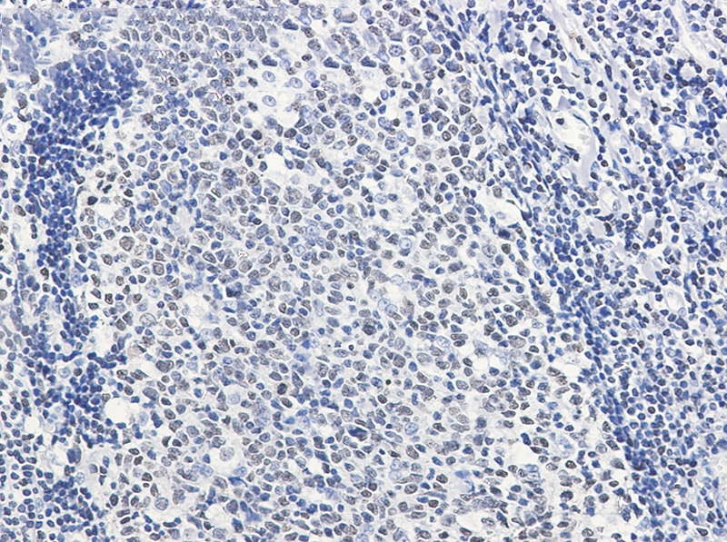 HMGB2 Rabbit mAb