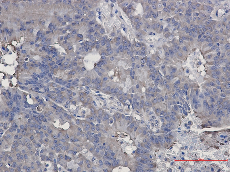 Hsp90 beta Rabbit mAb