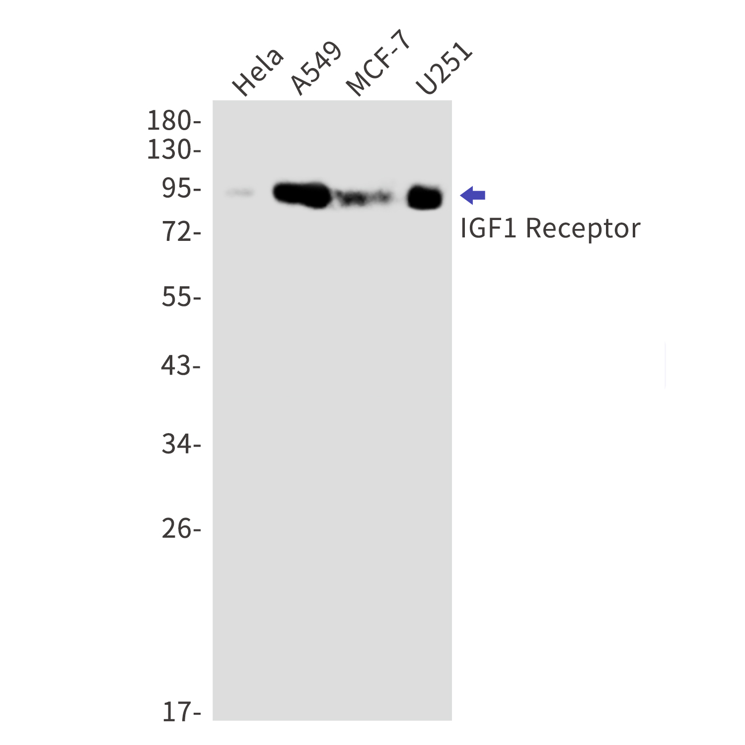 IGF1 Receptor Rabbit mAb