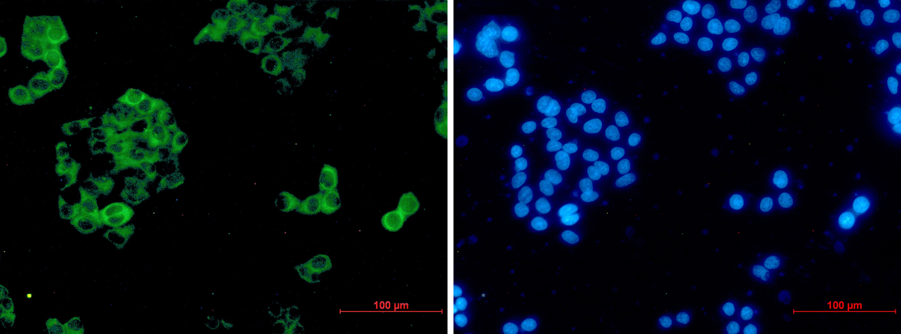 Insulin Degrading Enzyme Rabbit mAb