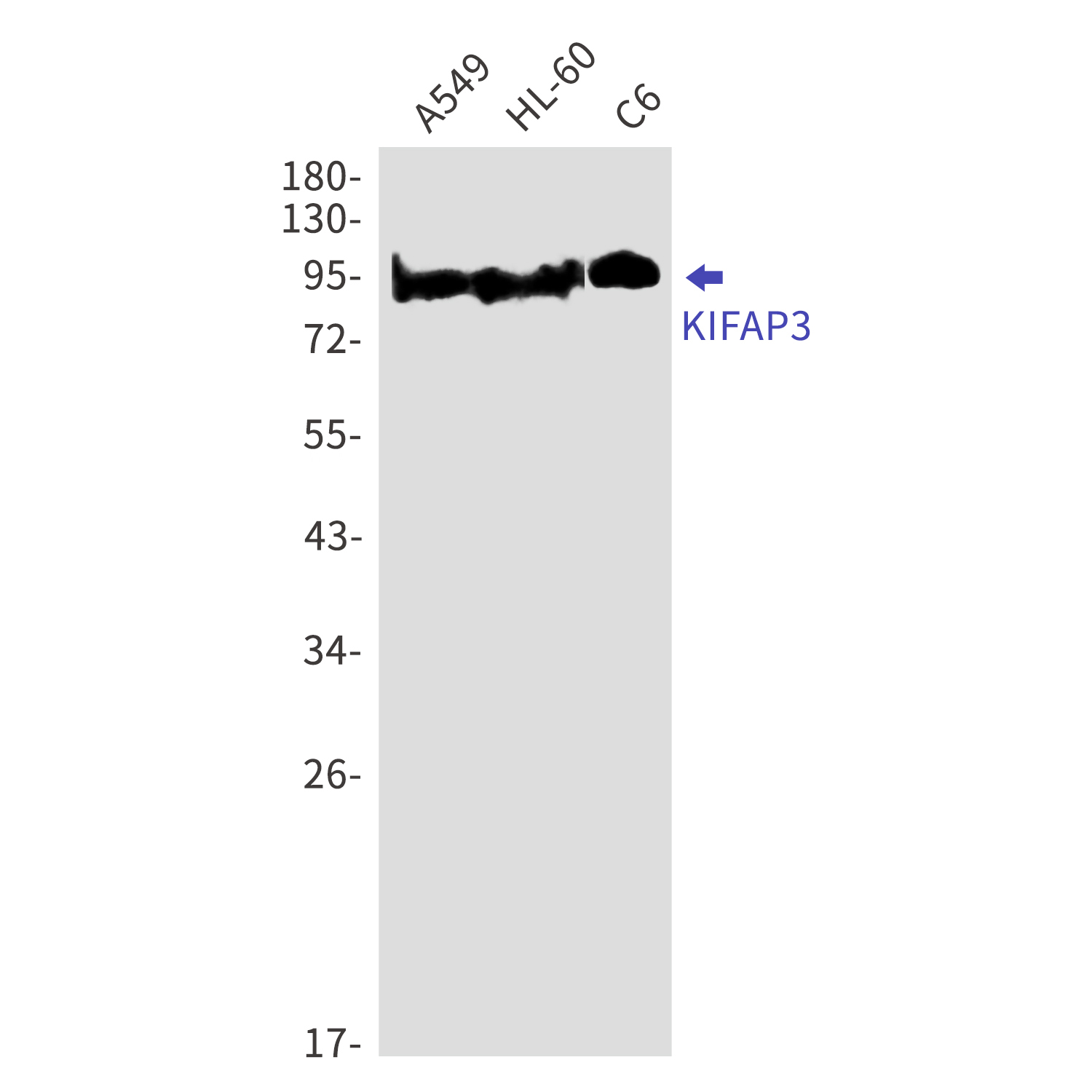 KIFAP3 Rabbit mAb