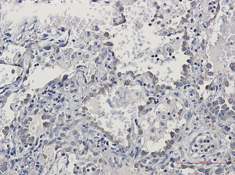 KIFAP3 Rabbit mAb