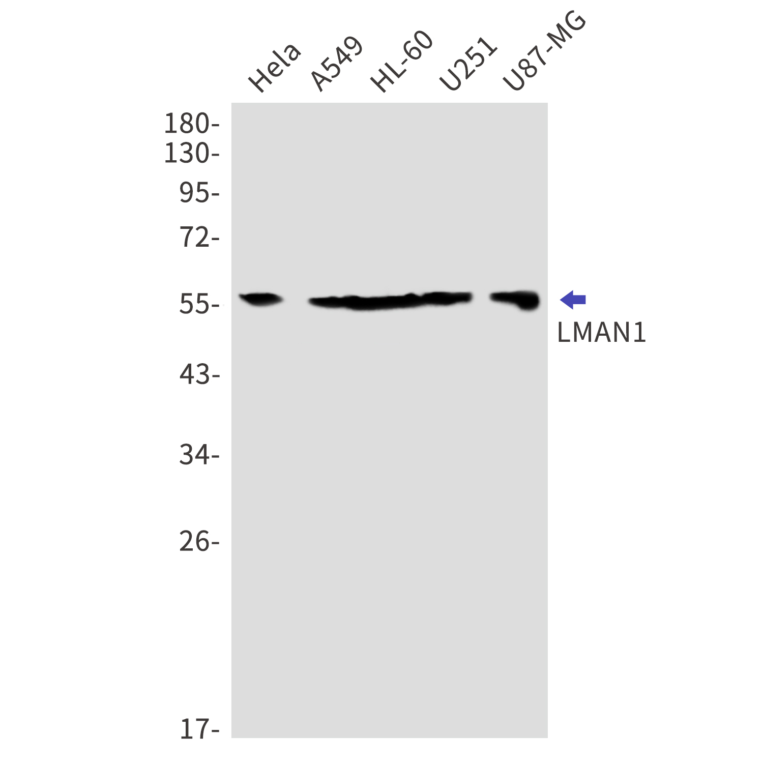 LMAN1 Rabbit mAb