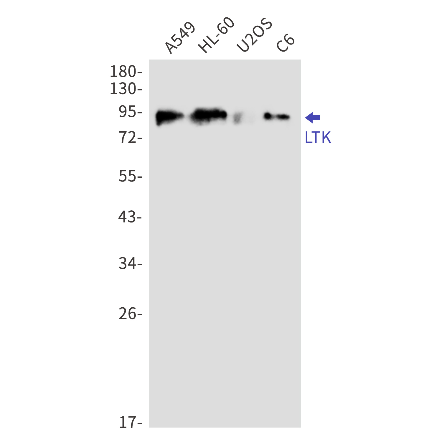 LTK Rabbit mAb