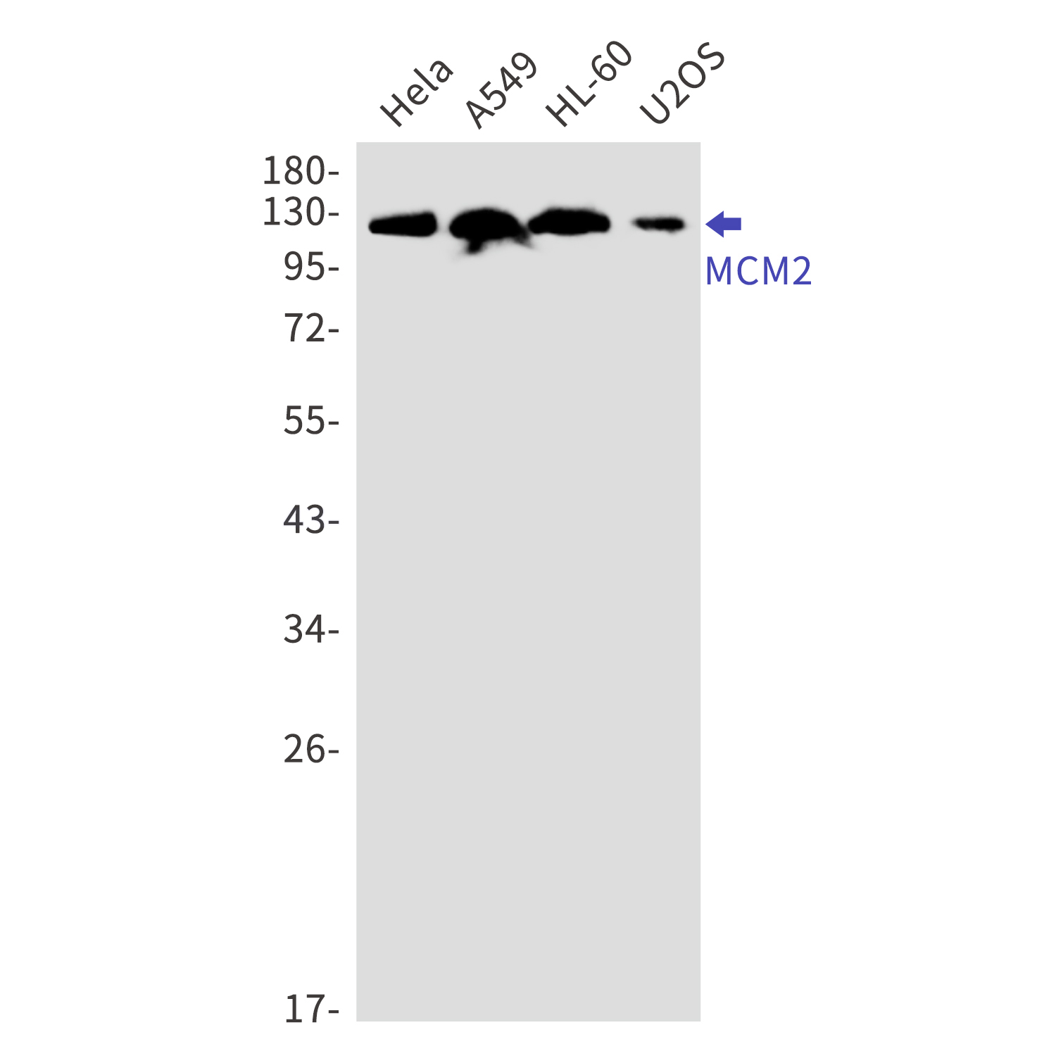 MCM2 Rabbit mAb