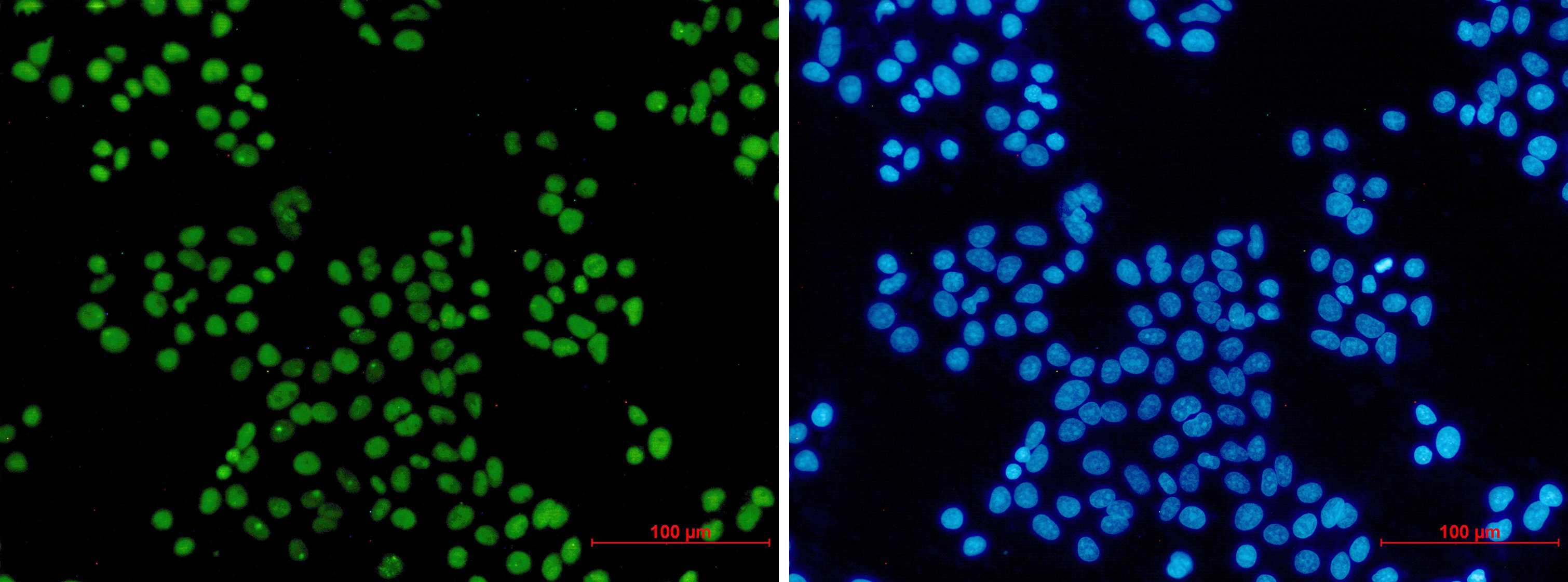 MCM2 Rabbit mAb