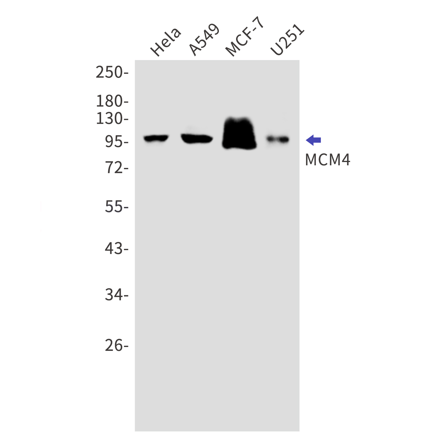 MCM4 Rabbit mAb