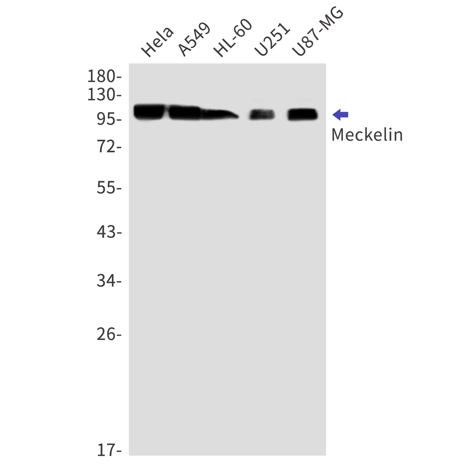 Meckelin Rabbit mAb