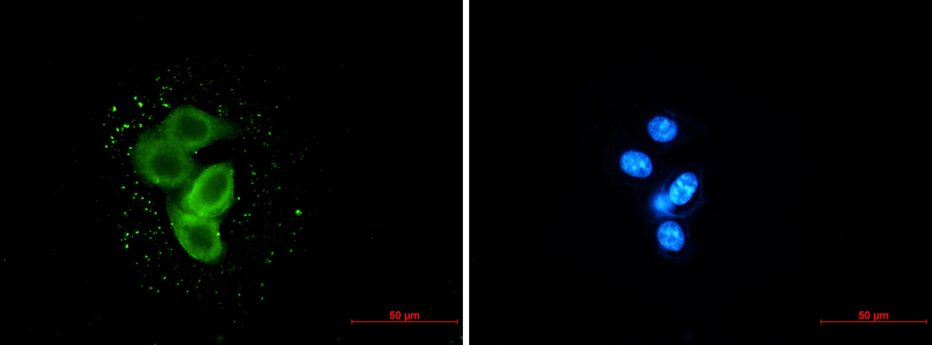 Meckelin Rabbit mAb