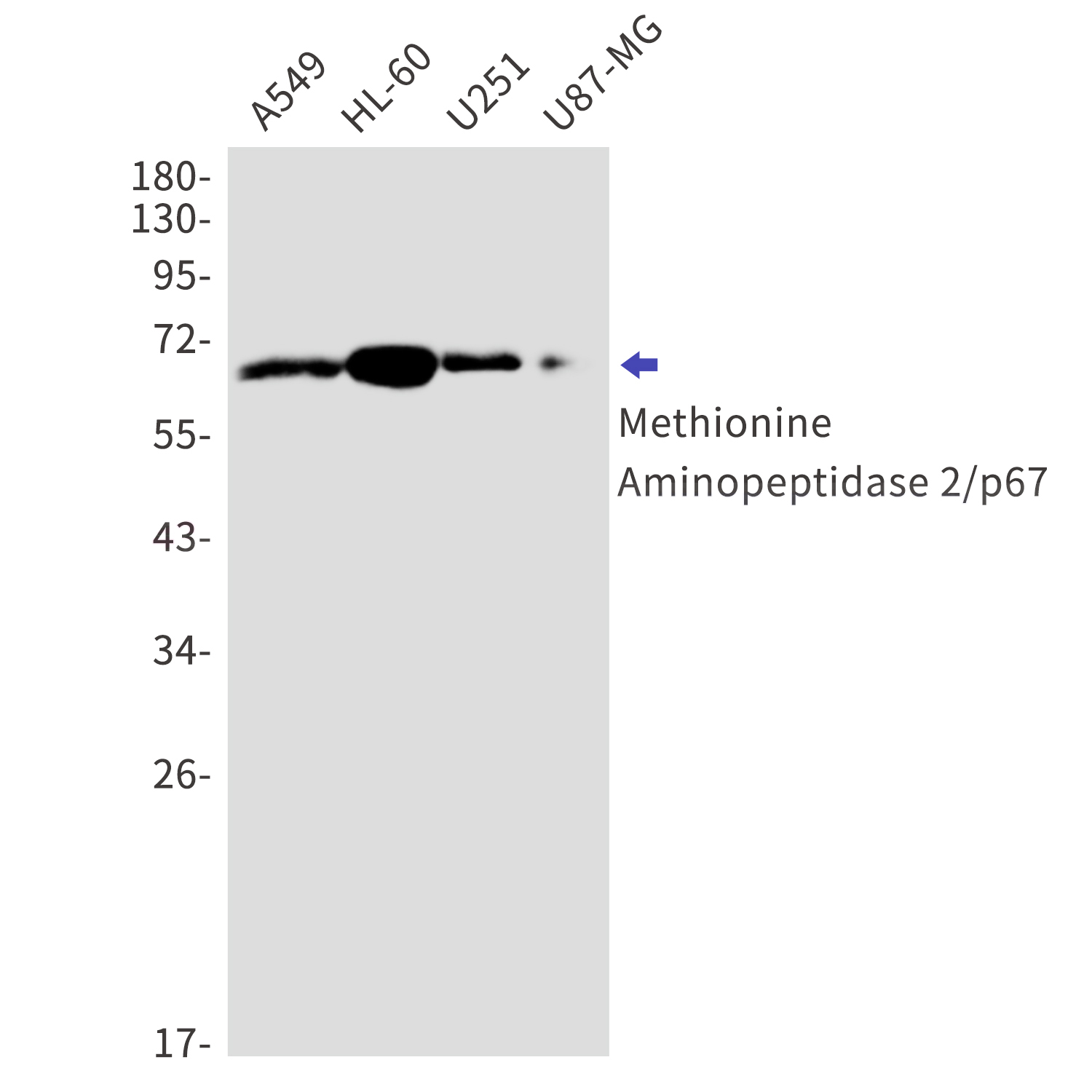 Methionine Aminopeptidase 2 Rabbit mAb