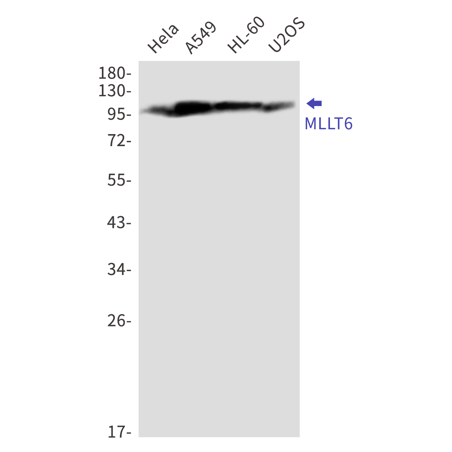 MLLT6 Rabbit mAb