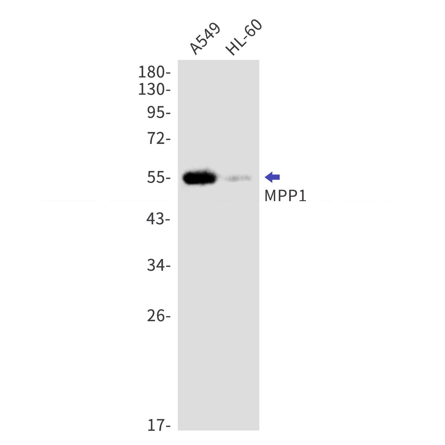 MPP1 Rabbit mAb