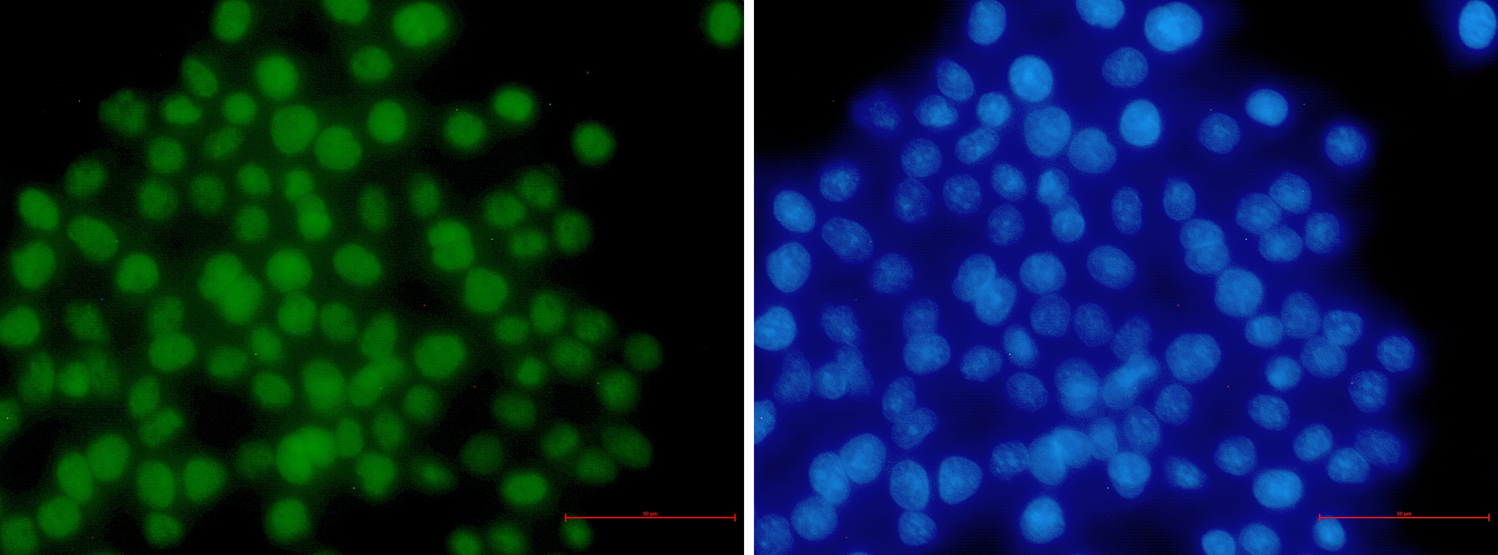 MSH6 Rabbit mAb