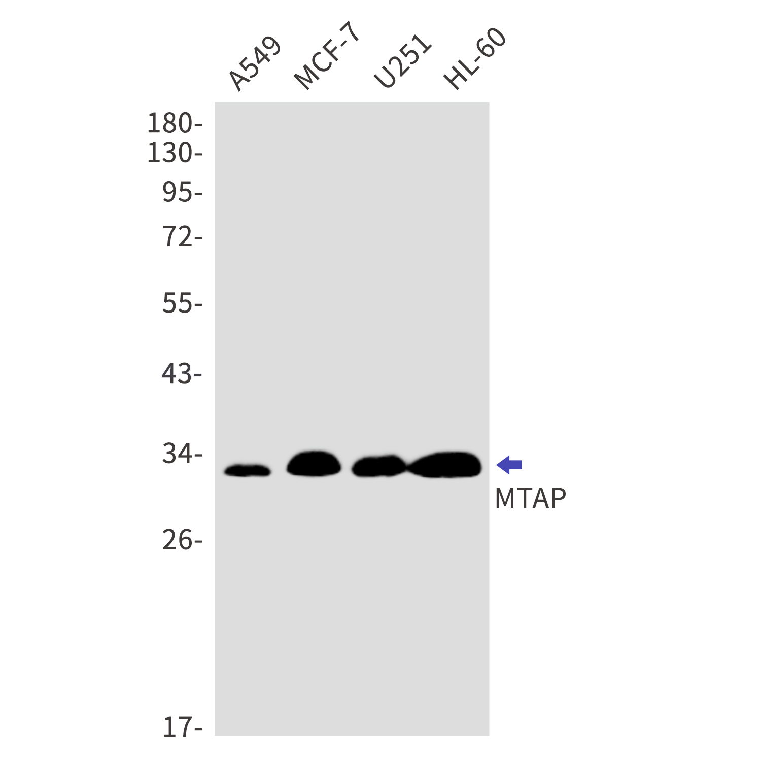 MTAP Rabbit mAb