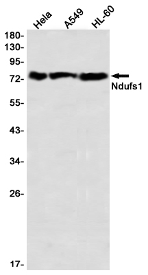 NDUFS1 Rabbit mAb