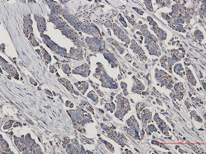 NDUFS1 Rabbit mAb