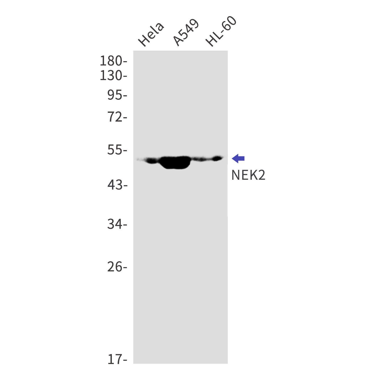 NEK2 Rabbit mAb