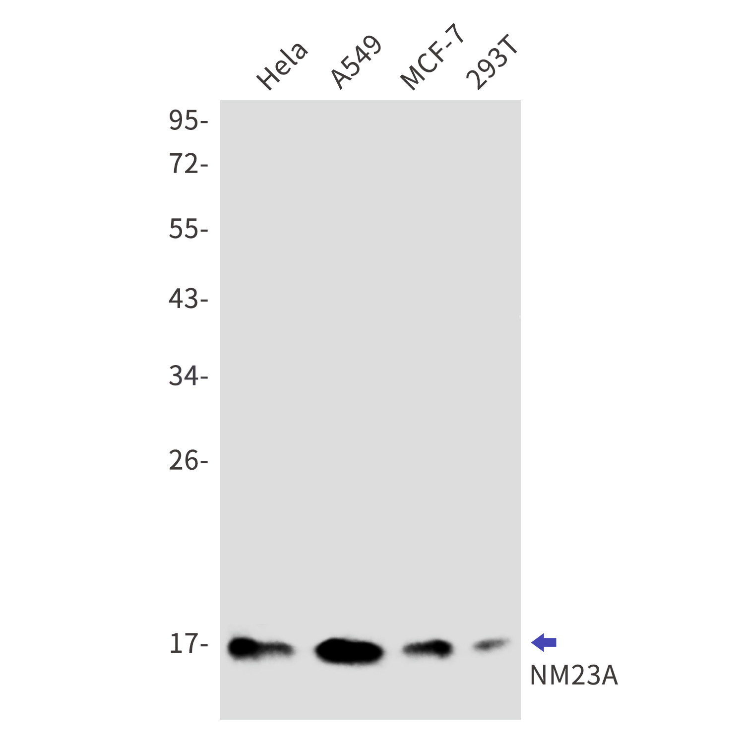 NM23A Rabbit mAb