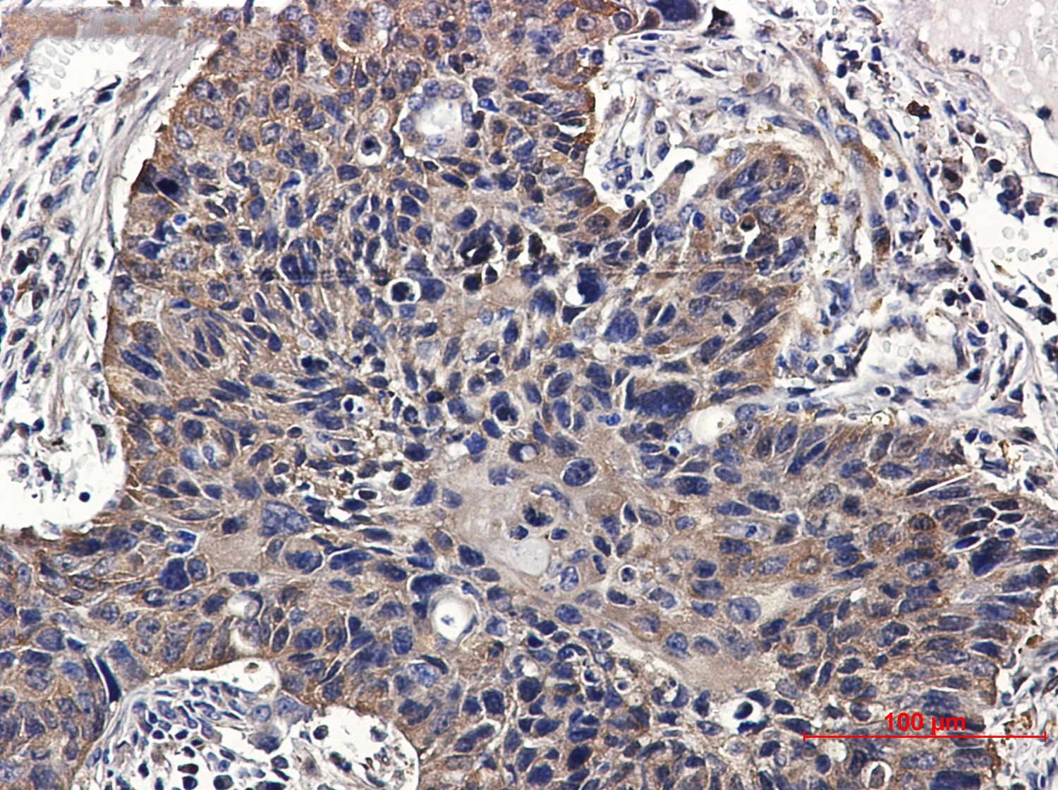 NME2 Rabbit mAb