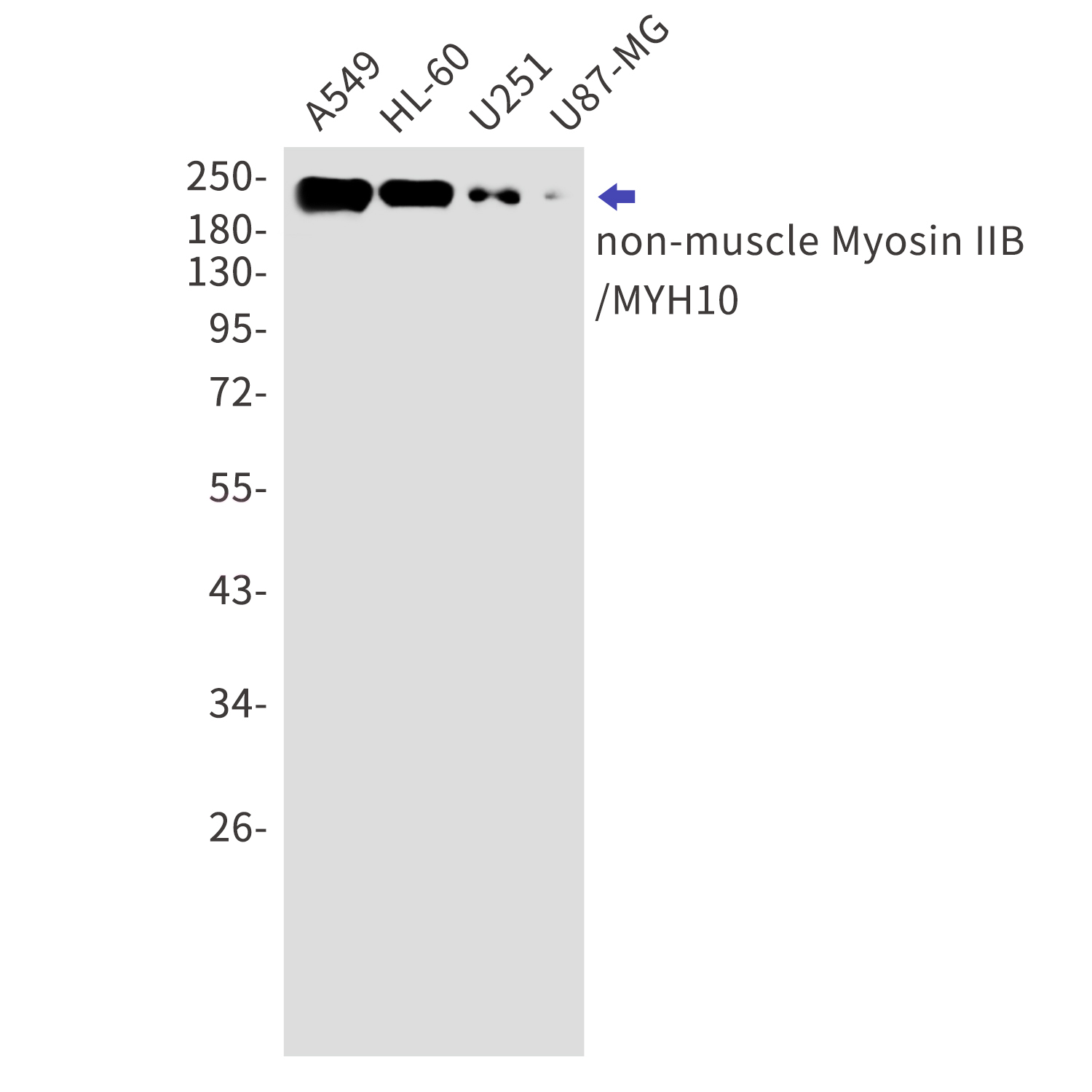 Myosin 10 Rabbit mAb