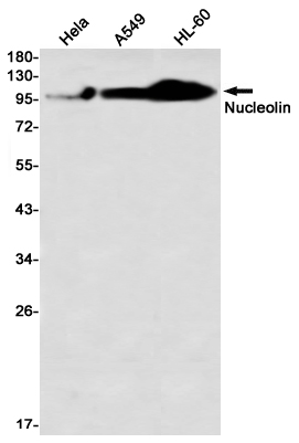 Nucleolin Rabbit mAb