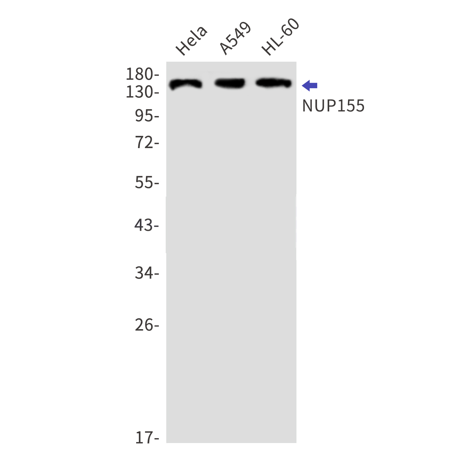 NUP155 Rabbit mAb