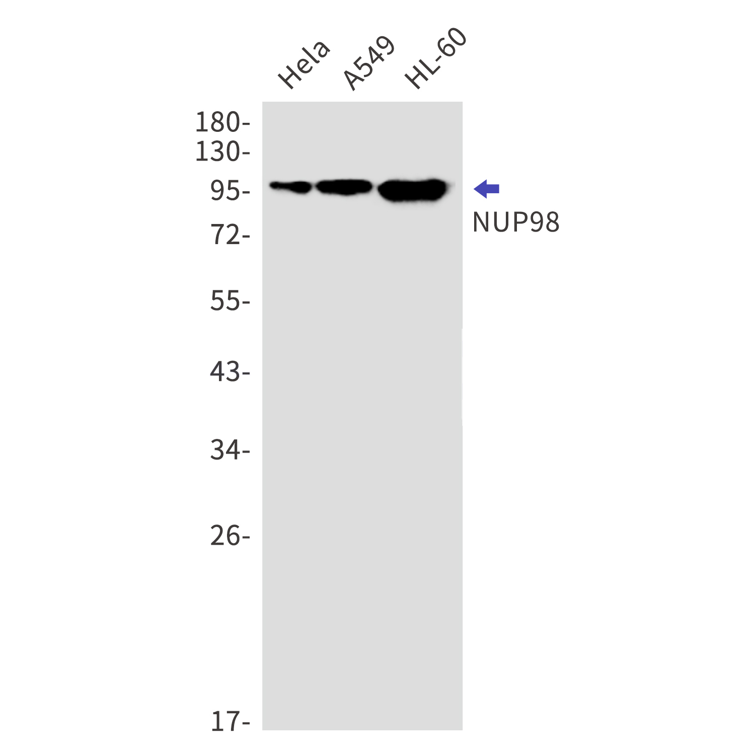 NUP98 Rabbit mAb