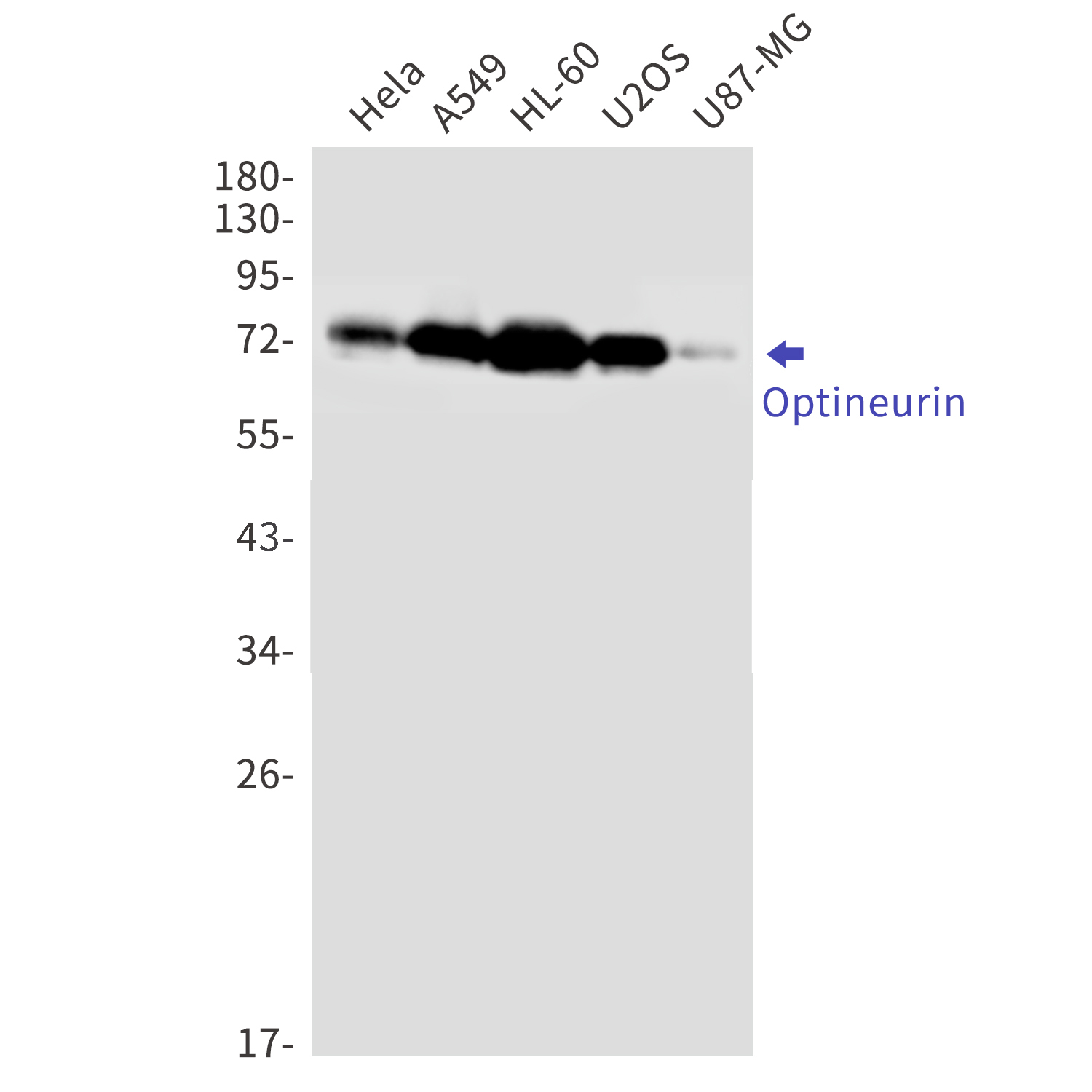 Optineurin Rabbit mAb