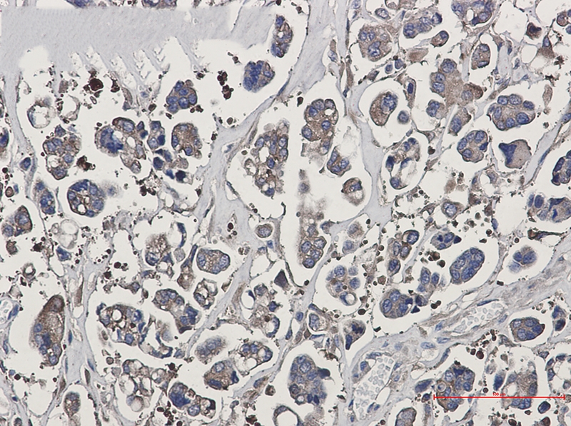 Optineurin Rabbit mAb