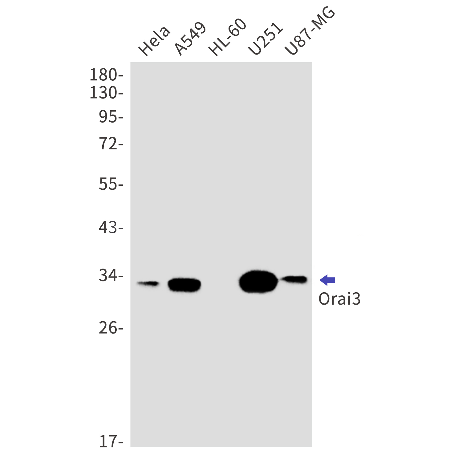 ORAI3 Rabbit mAb