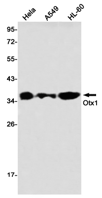 OTX1 Rabbit mAb