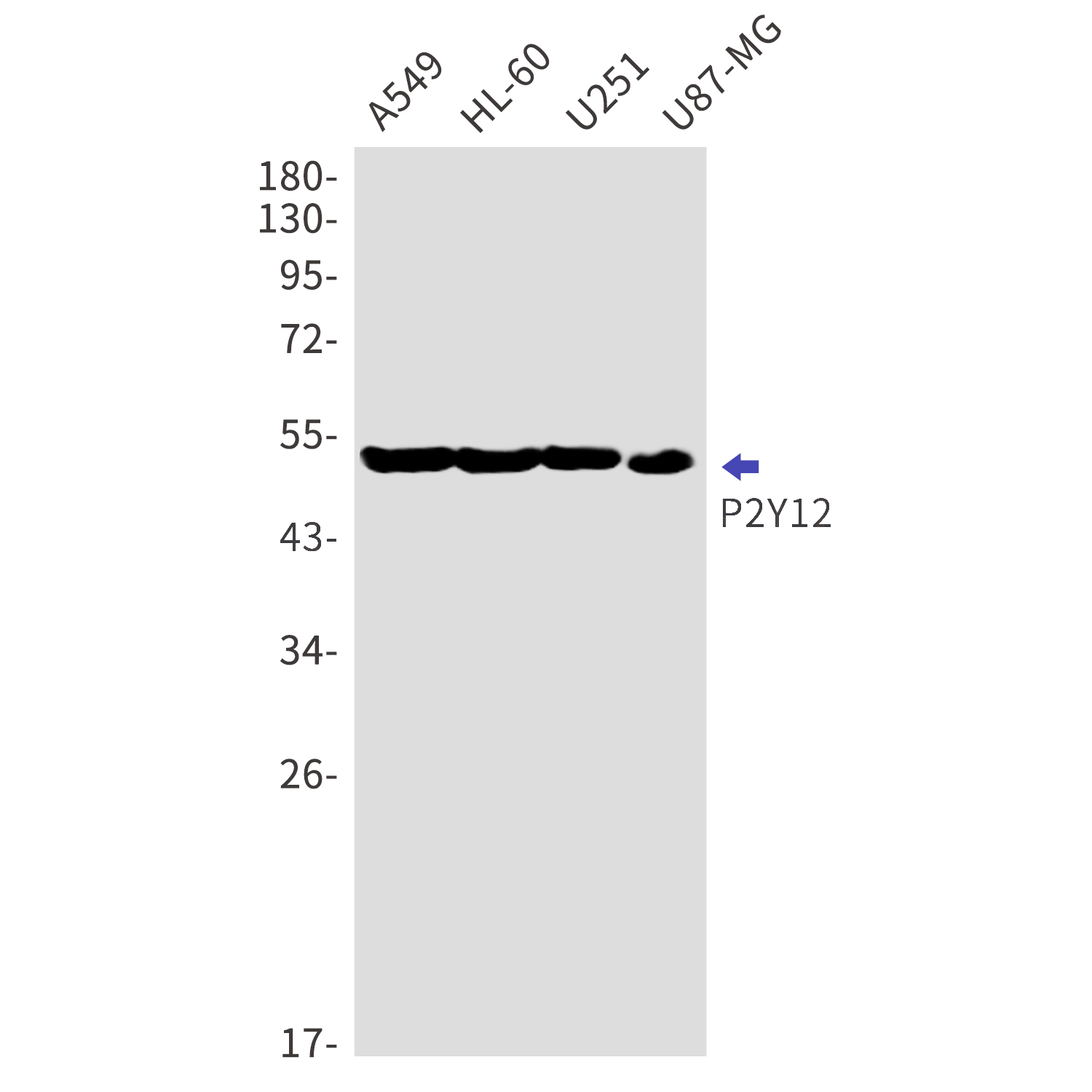 P2Y12 Rabbit mAb