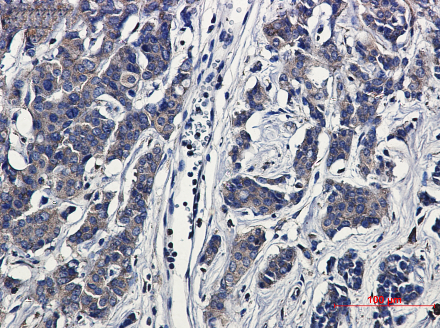 Paxillin Rabbit mAb