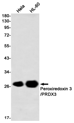 Peroxiredoxin 3 Rabbit mAb