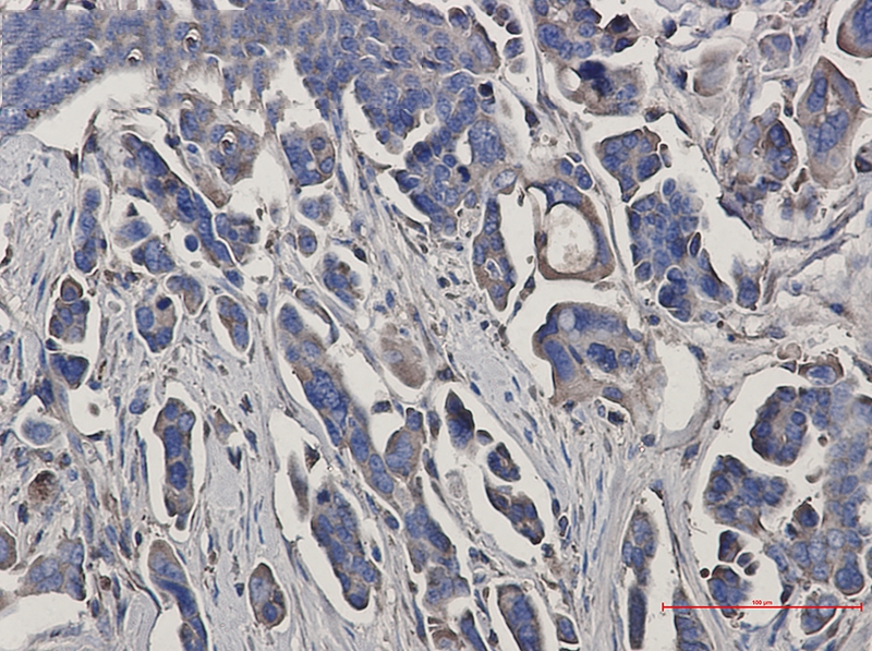 Peroxiredoxin 3 Rabbit mAb