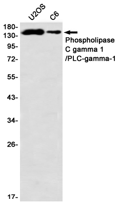 Phospholipase C gamma 1 Rabbit mAb