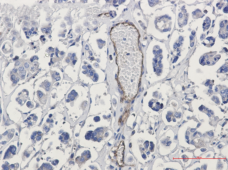 Poliovirus Receptor Rabbit mAb