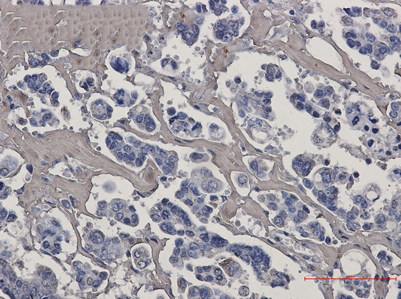 Caspase 7 Rabbit mAb