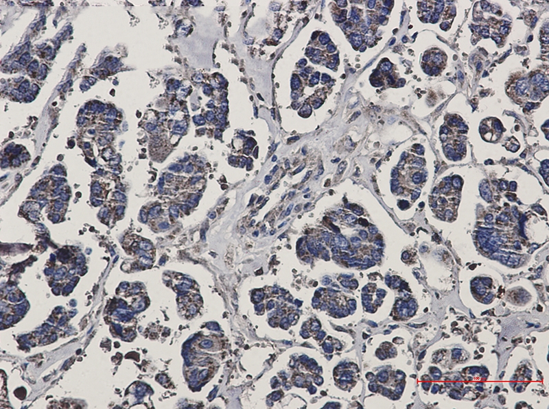 Prohibitin Rabbit mAb