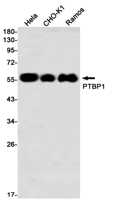 PTBP1 Rabbit mAb