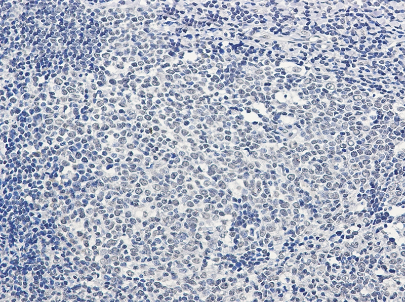 PTBP1 Rabbit mAb