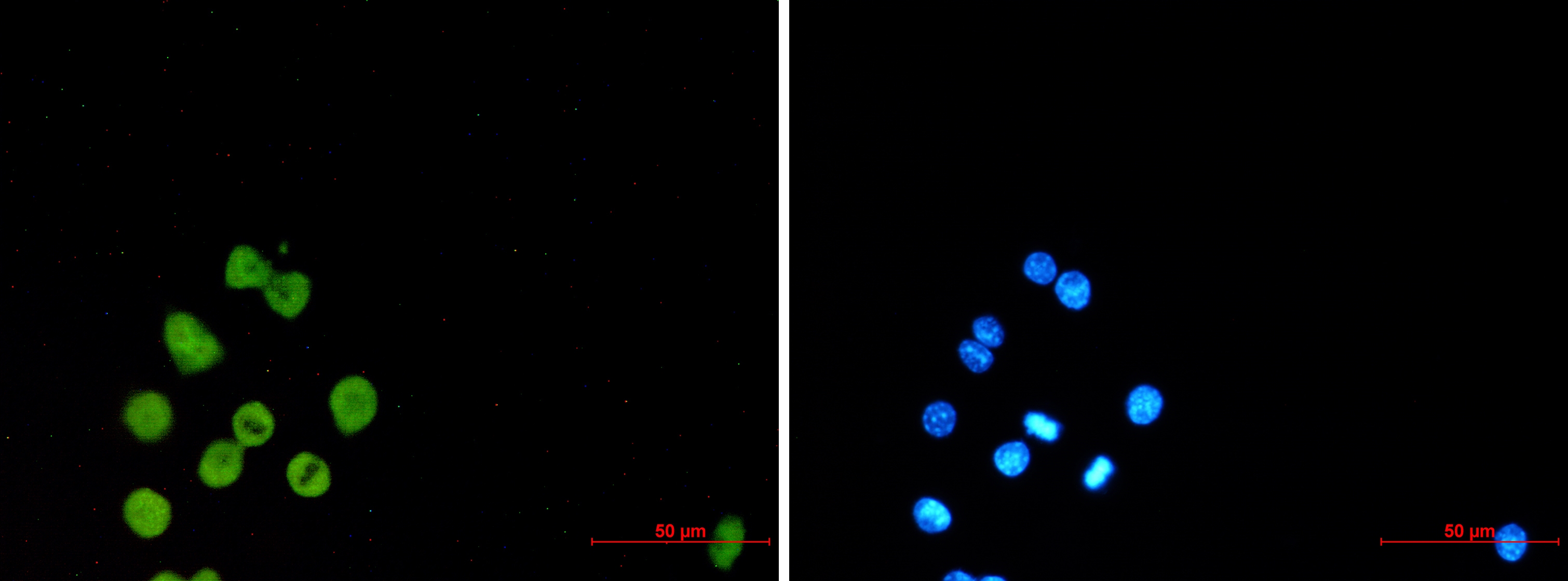 SPI1 Rabbit mAb