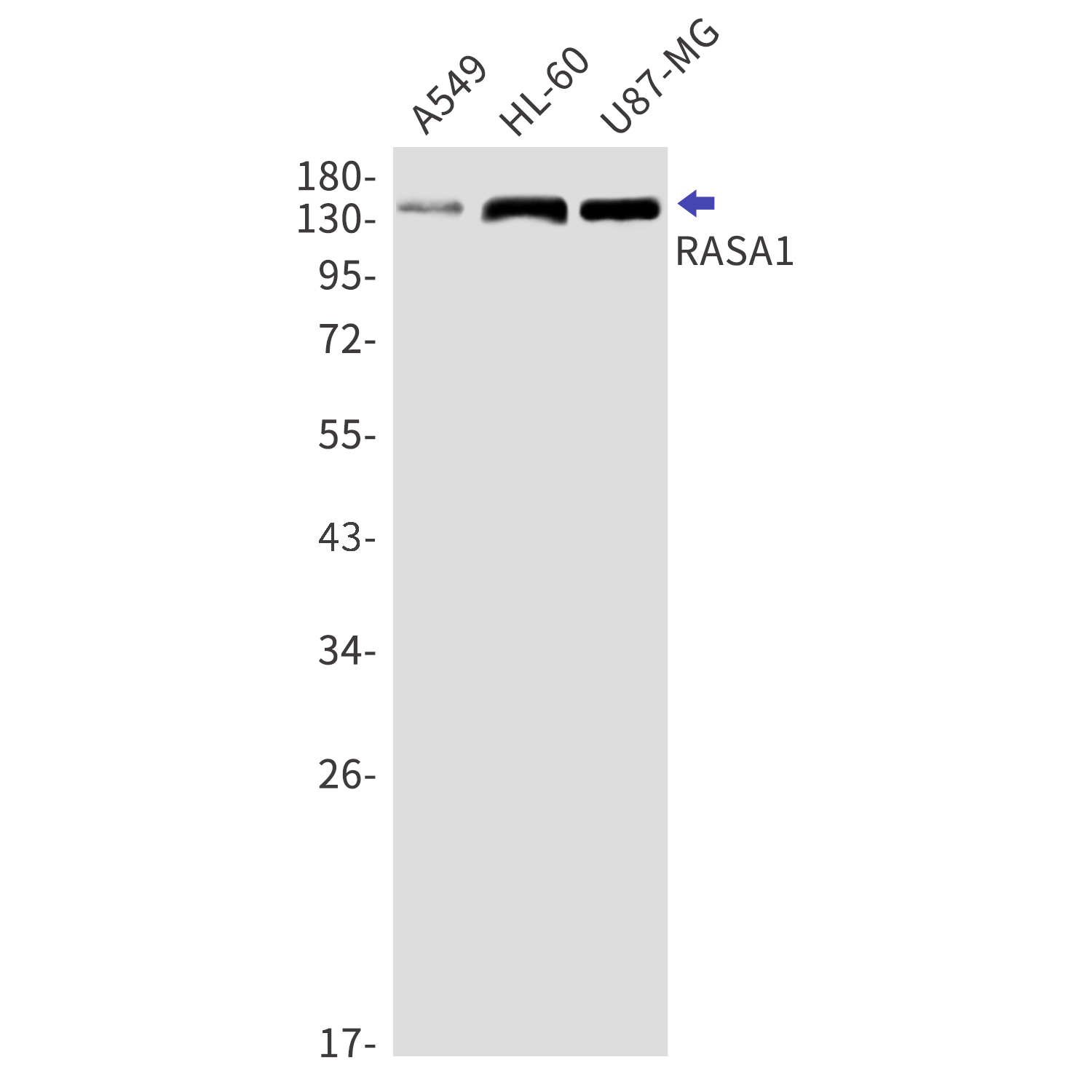 RASA1 Rabbit mAb