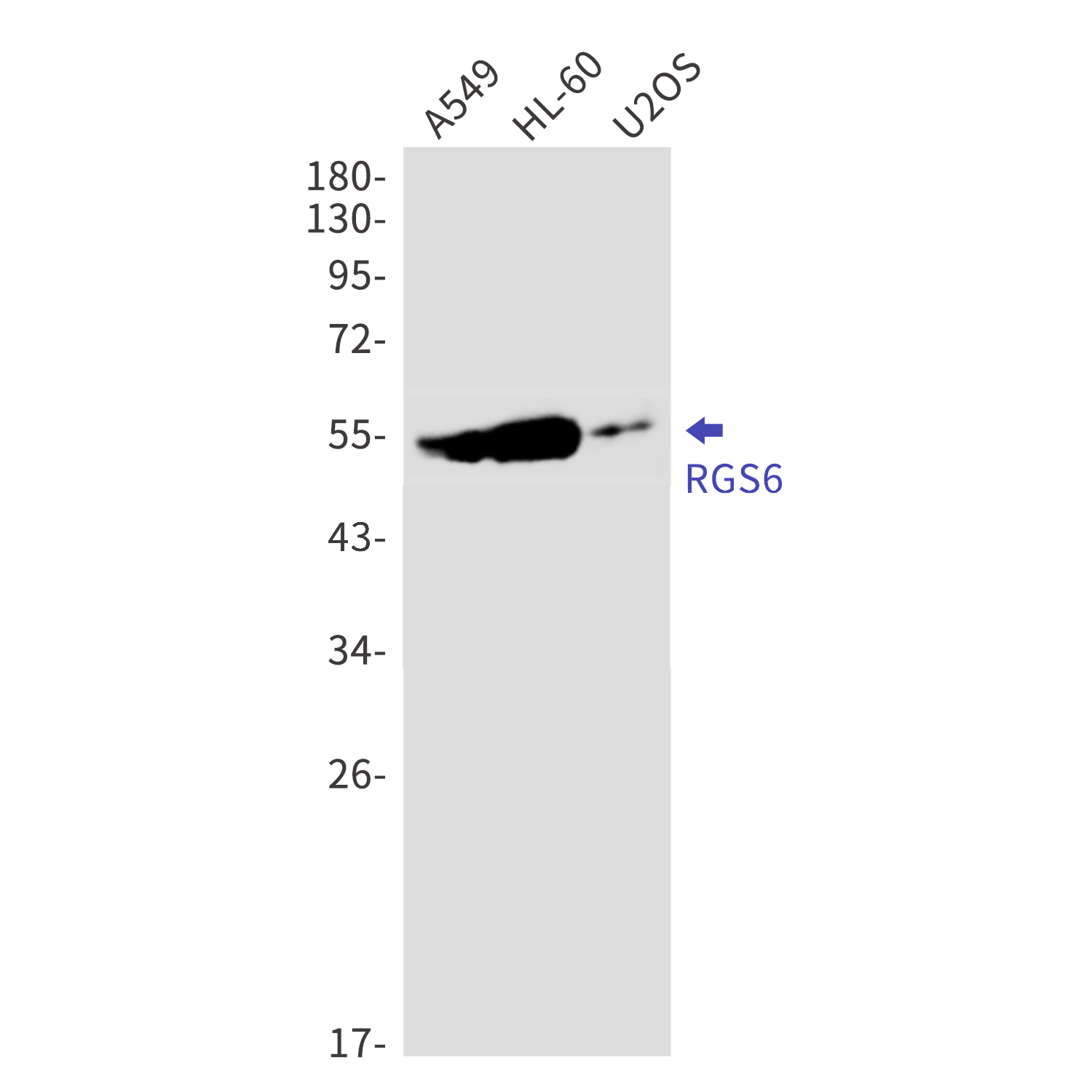 RGS6 Rabbit mAb