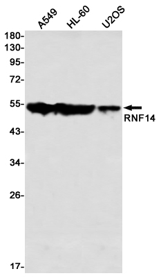 RNF14 Rabbit mAb