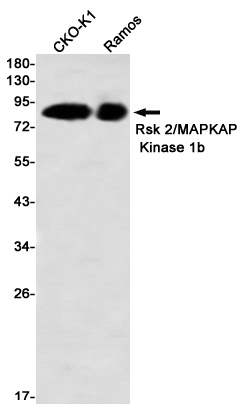 RSK2 Rabbit mAb