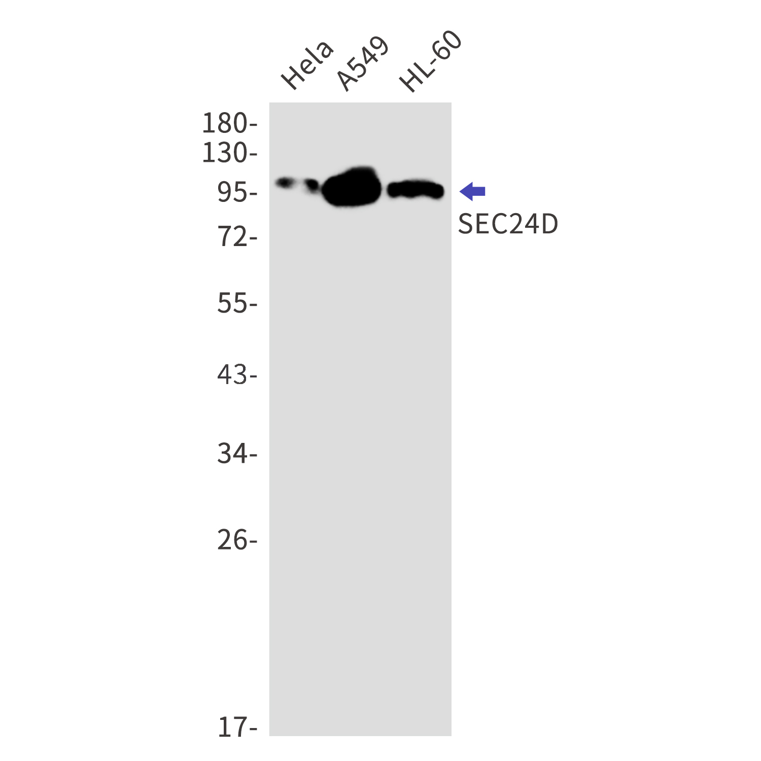 SEC24D Rabbit mAb